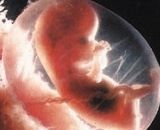 Почему и чем опасен аборт